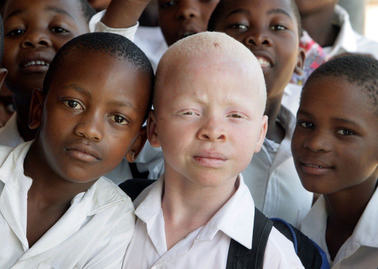 Albino - Pow - Bylge